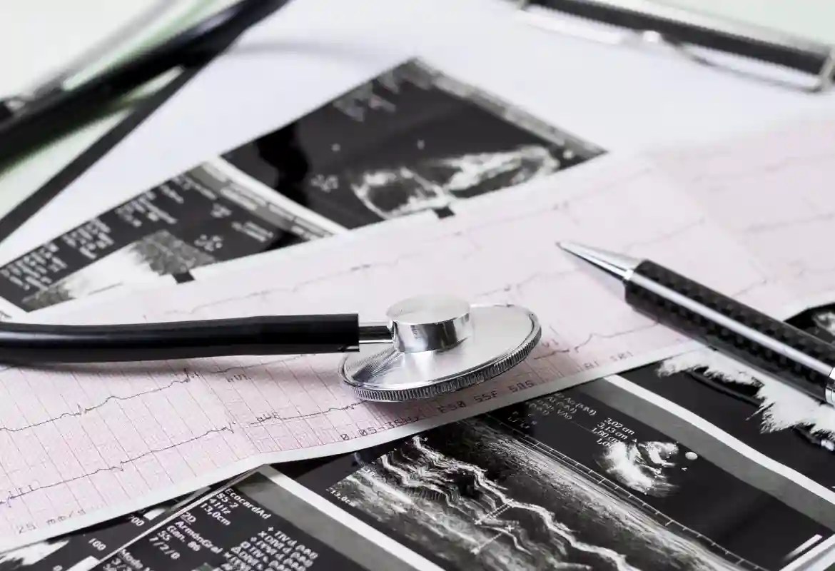 Colocación de stent femoral en Monterrey